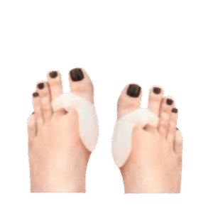 Anatomski silikonski štitnici COMBOfix